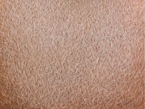 10 Steps to Smooth Keratosis Pilaris & Boost Confidence