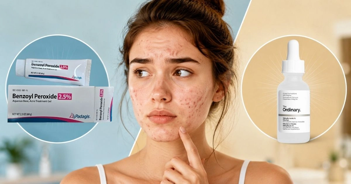 Benzoyl Peroxide vs Salicylic Acid: Which Clears Acne Faster